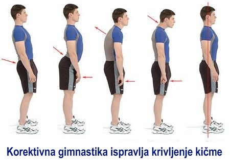 Korektivna-gimnastika-jogif