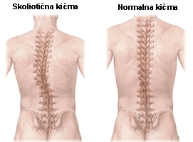 skoliozarw-jogif